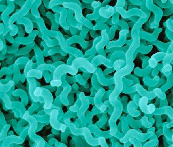 Picture of Picture of Campylobacter Jejuni