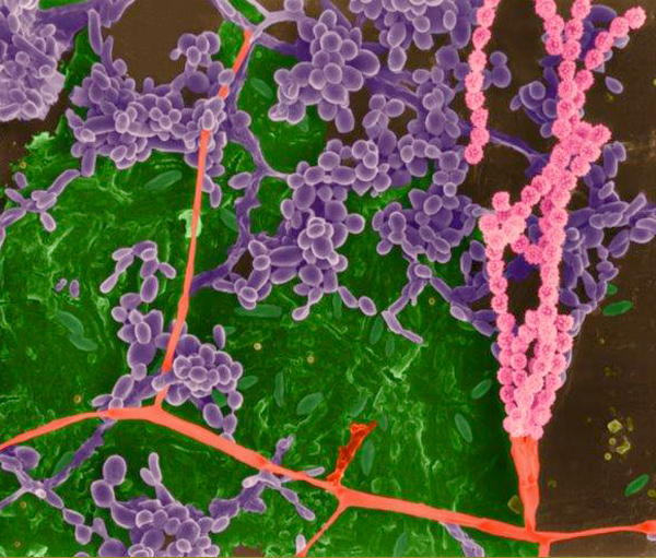 Picture of Picture of pathogens on a cutting board