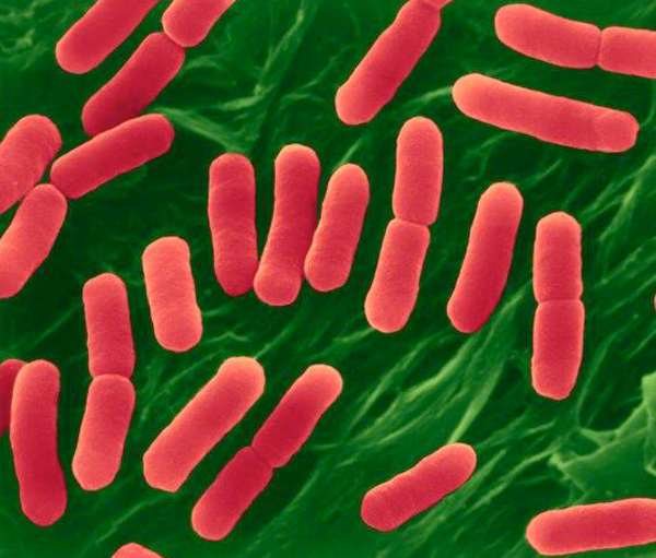 E Coli O157 H7 Escherichia Coli Expert Witness And Epidemiology Services