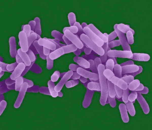 Picture of Picture of Legionella Pneumophillia
