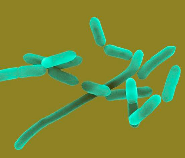 Picture of Picture of Listeria monocytogenes