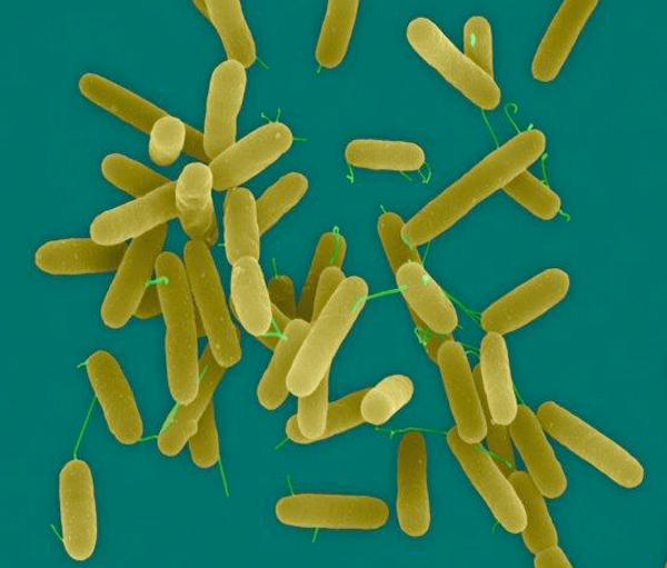 Picture of Picture of Pseudomonas aeruginosa