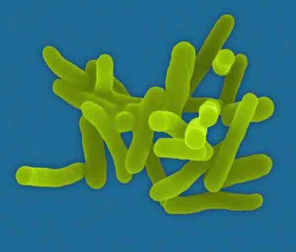 Picture of Picture of Shigella