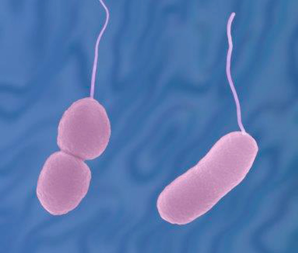 Picture of Picture of Vibrio Parahaemolyticus